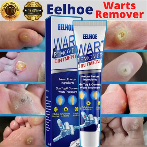 Kulugo (Wart) .